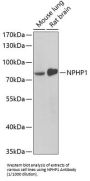 Nephrocystin 1 (NPHP1) Antibody