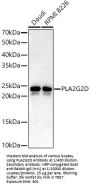 Phospholipase A2, Group II D (PLA2G2D) Antibody