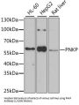 Bifunctional Polynucleotide Phosphatase/kinase (PNKP) Antibody