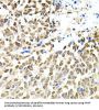 Bifunctional Polynucleotide Phosphatase/kinase (PNKP) Antibody