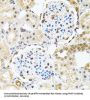 Bifunctional Polynucleotide Phosphatase/kinase (PNKP) Antibody