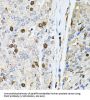 Bifunctional Polynucleotide Phosphatase/kinase (PNKP) Antibody
