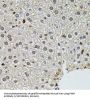 Bifunctional Polynucleotide Phosphatase/kinase (PNKP) Antibody