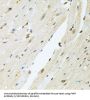 Bifunctional Polynucleotide Phosphatase/kinase (PNKP) Antibody