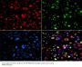 Bifunctional Polynucleotide Phosphatase/kinase (PNKP) Antibody