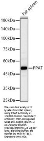Amidophosphoribosyltransferase (PPAT) Antibody