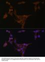 Amidophosphoribosyltransferase (PPAT) Antibody