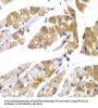 Protein Phosphatase 1 Regulatory Subunit 12A (PPP1R12A) Antibody