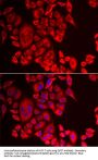 Glutaminyl-Peptide Cyclotransferase (QPCT) Antibody