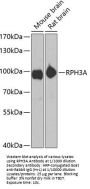 Rabphilin 3A (RPH3A) Antibody