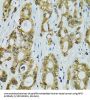 Ribosomal Protein S7 (RPS7) Antibody