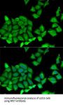 Ribosomal Protein S7 (RPS7) Antibody