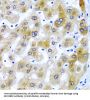 Selenocysteine Insertion Sequence-Binding Protein 2 (SECISBP2) Antibody