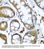Selenocysteine Insertion Sequence-Binding Protein 2 (SECISBP2) Antibody