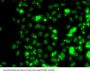 Selenocysteine Insertion Sequence-Binding Protein 2 (SECISBP2) Antibody