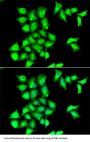 Methionine-R-Sulfoxide Reductase B1 (MSRB1) Antibody