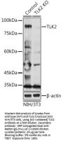 Serine/threonine-Protein Kinase Tousled-Like 2 (TLK2) Antibody
