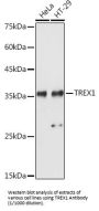 Three Prime Repair Exonuclease 1 (TREX1) Antibody