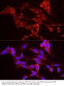 Three Prime Repair Exonuclease 1 (TREX1) Antibody
