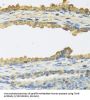 Thyrotropin Subunit Beta (TSHB) Antibody