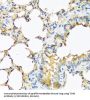 Thyrotropin Subunit Beta (TSHB) Antibody