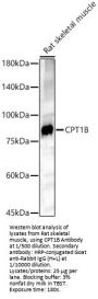 Carnitine Palmitoyltransferase 1B, Muscle (CPT1B) Antibody