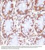 Carnitine Palmitoyltransferase 1B, Muscle (CPT1B) Antibody