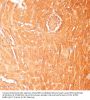 Carnitine Palmitoyltransferase 1B, Muscle (CPT1B) Antibody