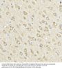 Acyl-CoA Synthetase Long Chain Family Member 4 (ACSL4) Antibody