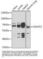 Polypeptide N-Acetylgalactosaminyltransferase 2 (GALNT2) Antibody