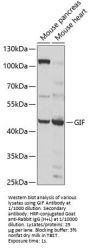Gastric Intrinsic Factor (GIF) Antibody