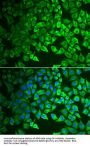 Gastric Intrinsic Factor (GIF) Antibody