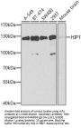 Huntingtin-Interacting Protein 1 (HIP1) Antibody