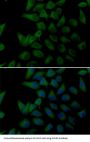 Procollagen Lysine-2-Oxoglutarate-5-Dioxygenase 2 (PLOD2) Antibody
