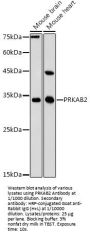 Protein Kinase, AMP Activated Beta 2 (PRKAB2) Antibody