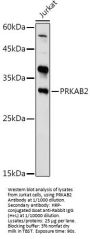 Protein Kinase, AMP Activated Beta 2 (PRKAB2) Antibody