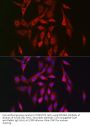 Protein Kinase, AMP Activated Beta 2 (PRKAB2) Antibody
