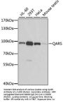 Glutaminyl tRNA Synthetase (QARS) Antibody