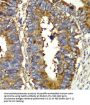 Glutaminyl tRNA Synthetase (QARS) Antibody