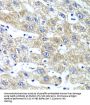 Glutaminyl tRNA Synthetase (QARS) Antibody