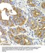Glutaminyl tRNA Synthetase (QARS) Antibody