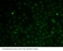 RAD51 Paralog C (RAD51C) Antibody