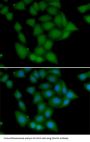 Calcium/Calmodulin Dependent Protein Kinase I (CAMK1) Antibody