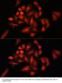 Signal Transducing Adaptor Molecule 2 (STAM2) Antibody
