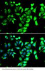 Peptidyl-Prolyl Cis-Trans Isomerase FKBP8 (FKBP8) Antibody