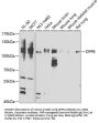 Dipeptidyl Peptidase 8 (DPP8) Antibody
