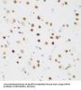 Cysteine/serine-Rich Nuclear Protein 1 (CSRNP1) Antibody