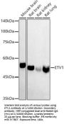 ETS Translocation Variant 1 (ETV1) Antibody