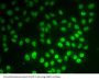 Small Nuclear Ribonucleoprotein Polypeptide D1 (SNRPD1) Antibody