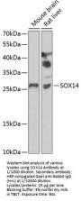 Sex Determining Region Y Box Protein 14 (SOX14) Antibody